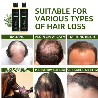 RootRise™ Volumizing Shampoo