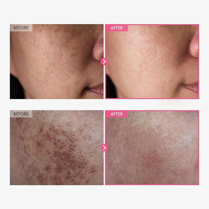 LumiSoft™ Brightening Cream