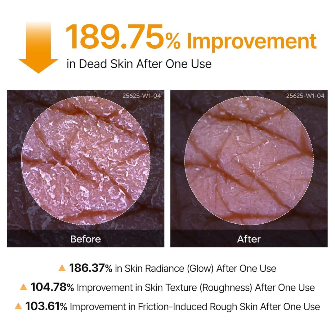 EyeCalm™ Acid Turmeric Exfoliating Spray