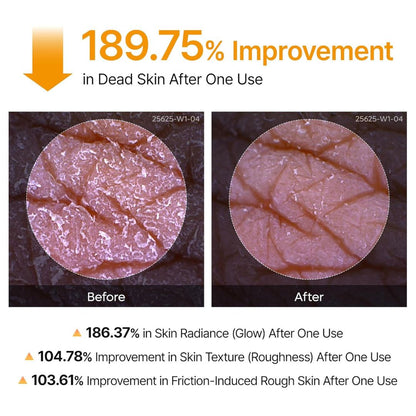 EyeCalm™ Acid Turmeric Exfoliating Spray